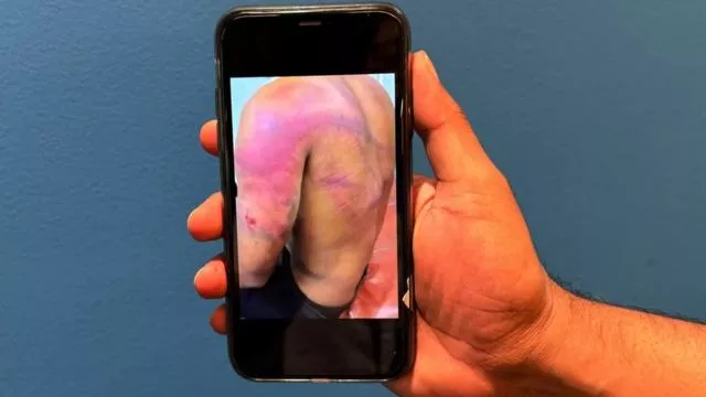 “网络奴隶”：被困缅甸电信诈骗园区的亲身经历